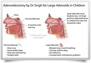 Ear Nose and Throat Operating Theatres