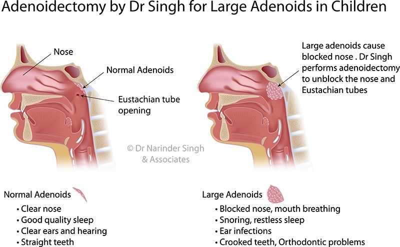 inside a stuffy nose