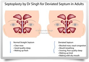 Ear Nose and Throat Operating Theatres