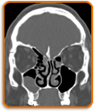 Sinus Problems - GP